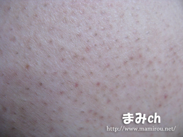 改善前の、肌荒れした部分