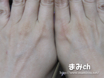 両手の色を比較